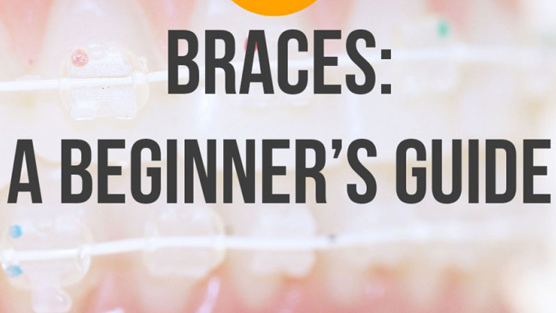 braces: a beginners guide