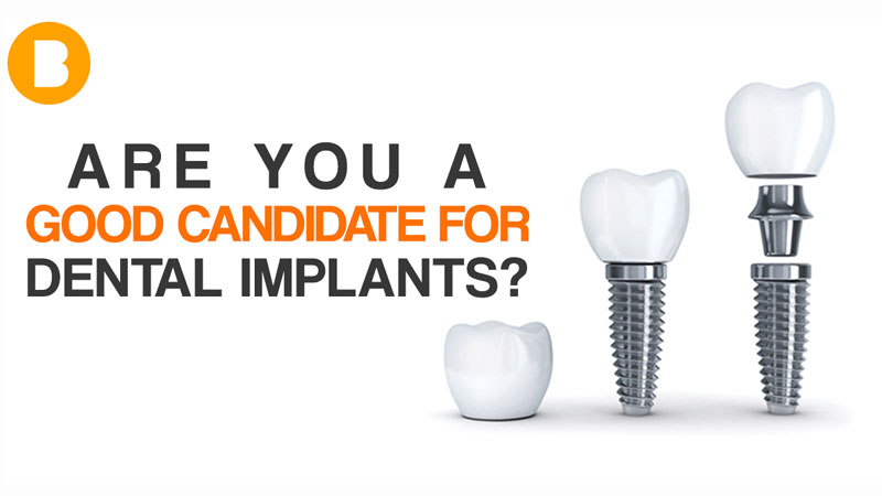 good candidate dental implants